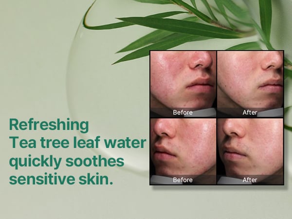 Some By Mi 30 Days Miracle Face Cream AHA-BHA-PHA 60g
