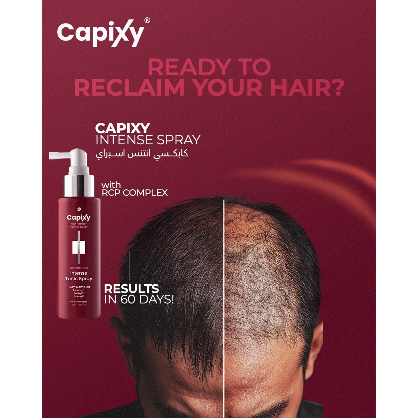 Capixy Intense Tonic Spray