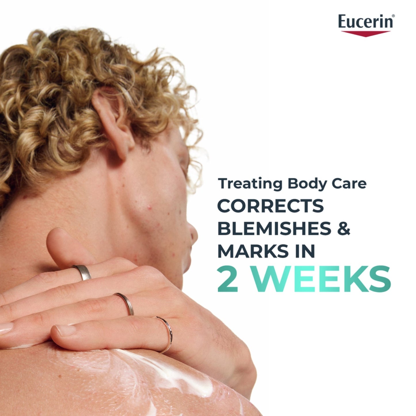 Eucerin Dermopure Clinical تونر منقي لحب الشباب والعيوب والرؤوس السوداء، 200 مل