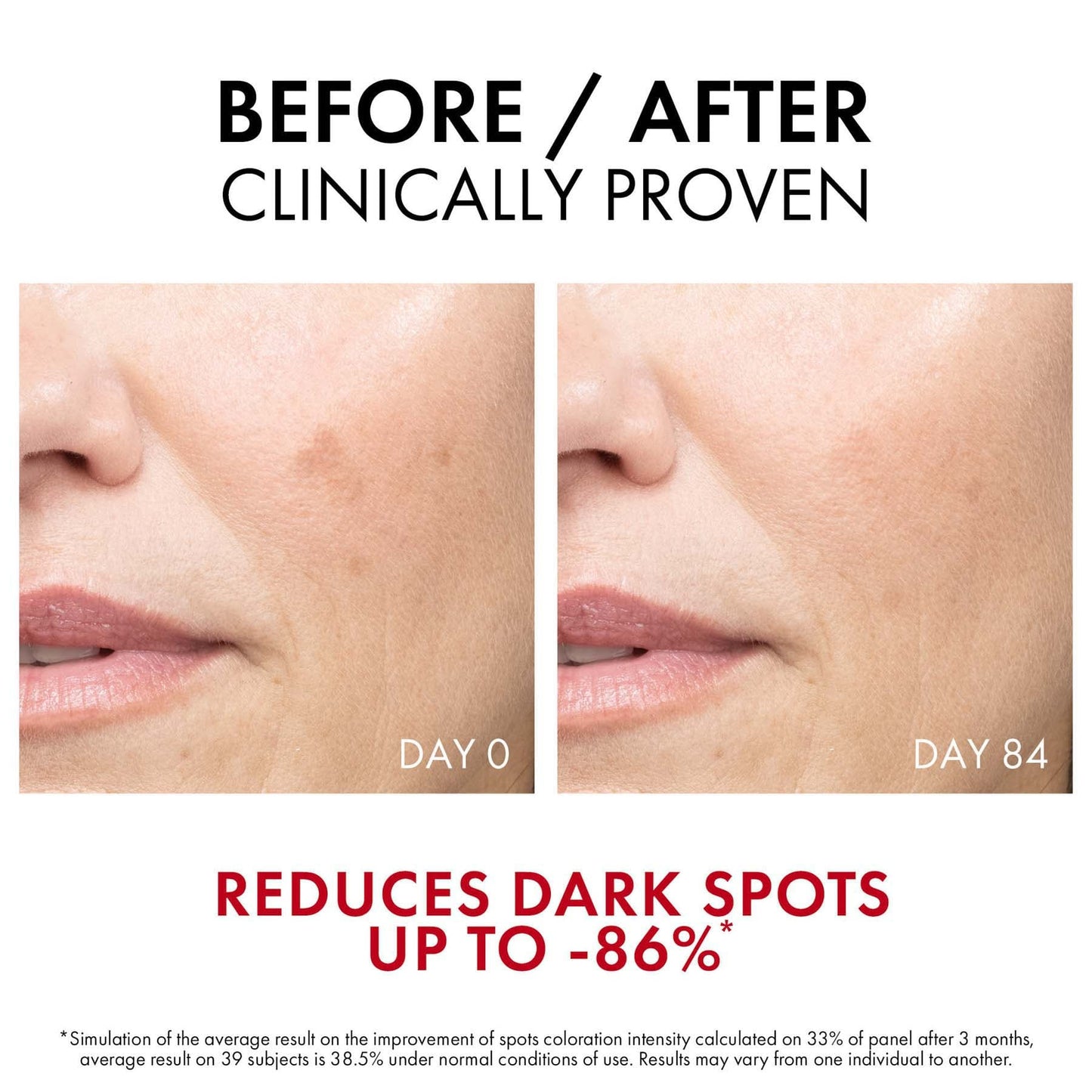 Vichy Liftactiv B3 Serum for Dark Spots