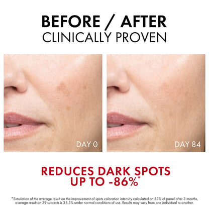 Vichy Liftactiv B3 Serum for Dark Spots