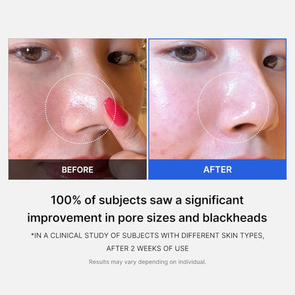 Medicube Zero Pore Pads 2.0 (70 Pads)