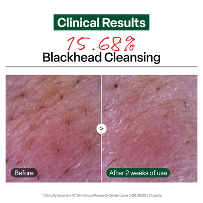Dr.G Green Deep Cleansing Oil 310ml
