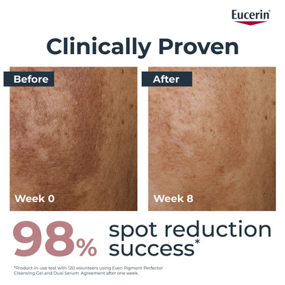 إيفن بيجمنت بيرفيكتور كريم النهار SPF30 50 مل