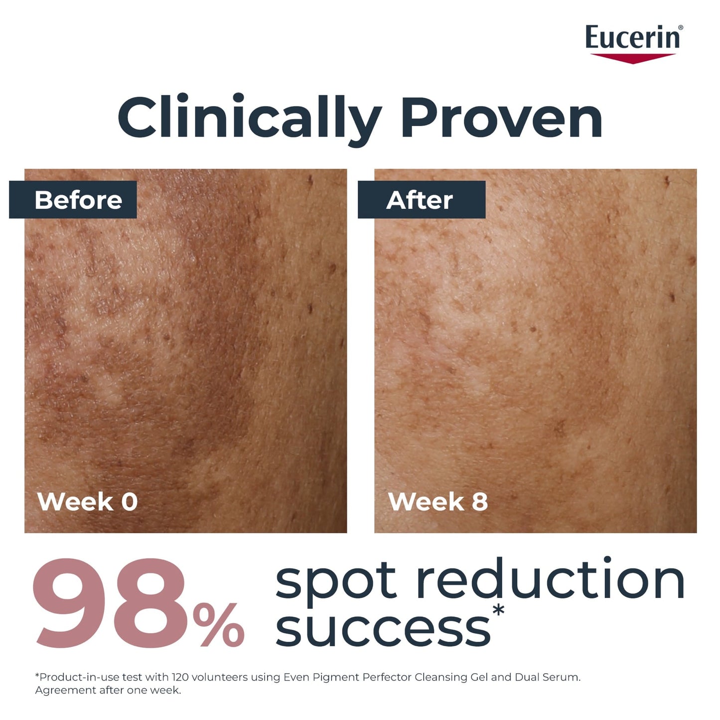 كريم سيروم الوجه المزدوج Eucerin Even Pigment Perfector 30 مل