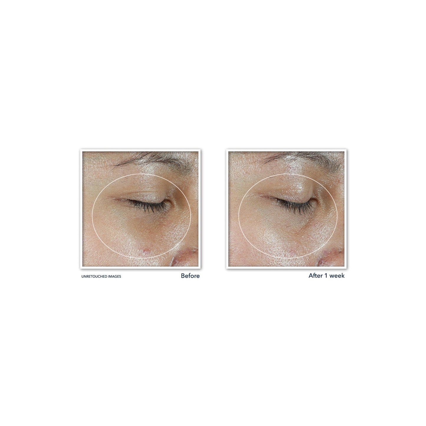 Roc Multi Correxion Revive + Glow Eye Stick